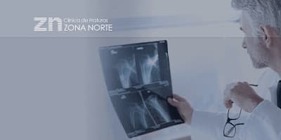 Clínica de Fraturas Zona Norte