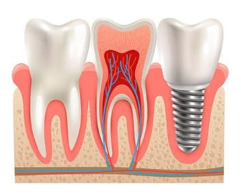 Augusto Maffei Cordeiro - Dentista - foto 5