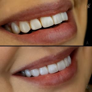 Oral Sin Implantes - Moema