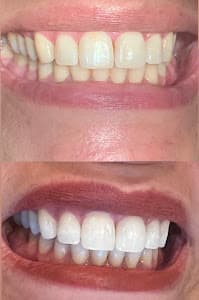 Dra Giulia Augustineli - Dentista em Santana/zona norte sp