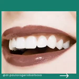Consultório Dentário Dr. Paulo Rogério Barbosa em Pinheiros